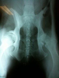 Photo of Radiographs of Severe Hip Dysplasia and Osteoarthritis